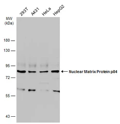 Anti-Nuclear Matrix Protein p84 antibody [C1C3] used in Western Blot (WB). GTX102919