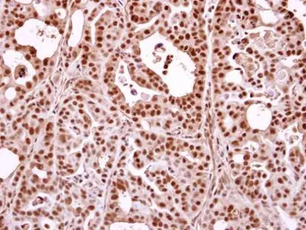 Anti-Nuclear Matrix Protein p84 antibody [C1C3] used in IHC (Paraffin sections) (IHC-P). GTX102919