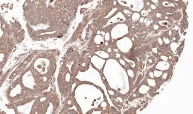 Anti-MMP12 antibody [N3C3] used in IHC (Paraffin sections) (IHC-P). GTX102928