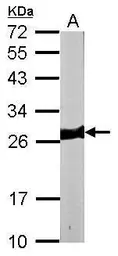 Anti-Myosin Light Chain 3 antibody [N1C3] used in Western Blot (WB). GTX102930