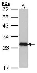 Anti-Myosin Light Chain 3 antibody [N1C3] used in Western Blot (WB). GTX102930