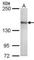 Anti-Cav1.1 antibody [N2N3] used in Western Blot (WB). GTX102941