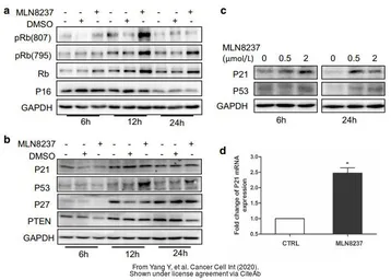 Anti-p53 antibody used in Western Blot (WB). GTX102965