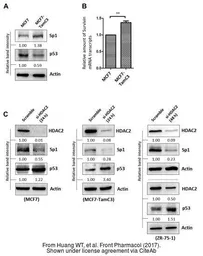 Anti-p53 antibody used in Western Blot (WB). GTX102965