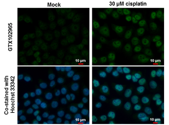 Anti-p53 antibody used in Immunocytochemistry/ Immunofluorescence (ICC/IF). GTX102965