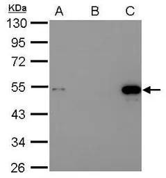 Anti-p53 antibody used in Immunoprecipitation (IP). GTX102965