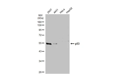 Anti-p53 antibody used in Western Blot (WB). GTX102965