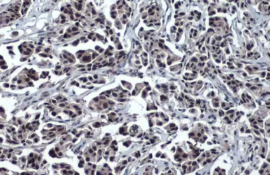 Anti-p53 antibody used in IHC (Paraffin sections) (IHC-P). GTX102965