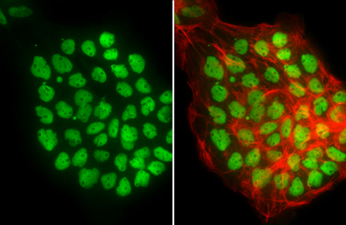 Anti-p53 antibody used in Immunocytochemistry/ Immunofluorescence (ICC/IF). GTX102965