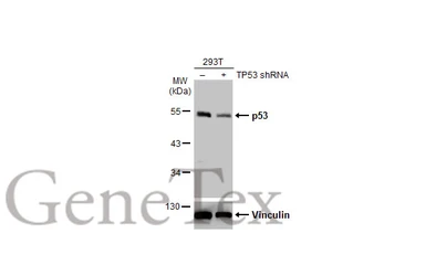 Anti-p53 antibody used in Western Blot (WB). GTX102965