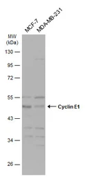 Anti-Cyclin E1 antibody used in Western Blot (WB). GTX103045