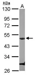 Anti-Cyclin E1 antibody used in Western Blot (WB). GTX103045