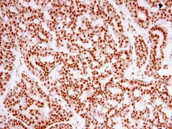 Anti-TAF15 antibody [N1N3] used in IHC (Paraffin sections) (IHC-P). GTX103116