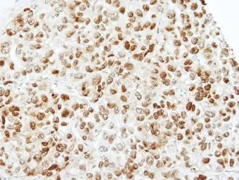 Anti-TAF15 antibody [N1N3] used in IHC (Paraffin sections) (IHC-P). GTX103116