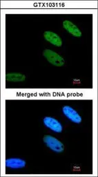 Anti-TAF15 antibody [N1N3] used in Immunocytochemistry/ Immunofluorescence (ICC/IF). GTX103116