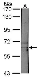 Anti-TAF15 antibody [N1N3] used in Western Blot (WB). GTX103116