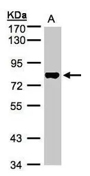 Anti-TAF15 antibody [N1N3] used in Western Blot (WB). GTX103116