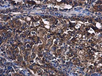 Anti-STAT2 antibody [C2C3], C-term used in IHC (Paraffin sections) (IHC-P). GTX103117