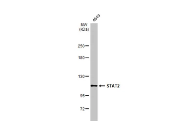 Anti-STAT2 antibody [C2C3], C-term used in Western Blot (WB). GTX103117