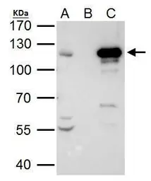 Anti-STAT2 antibody [C2C3], C-term used in Immunoprecipitation (IP). GTX103117