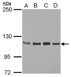 Anti-STAT2 antibody [C2C3], C-term used in Western Blot (WB). GTX103117