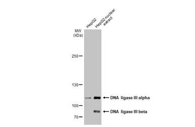 Anti-DNA ligase III antibody [C2C3], C-term used in Western Blot (WB). GTX103197