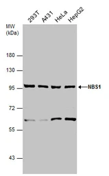 Anti-NBS1 antibody used in Western Blot (WB). GTX103229