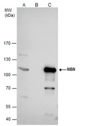 Anti-NBS1 antibody used in Immunoprecipitation (IP). GTX103229