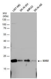 Anti-SOD2 antibody used in Western Blot (WB). GTX103230