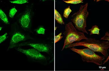 Anti-mtTFA antibody used in Immunocytochemistry/ Immunofluorescence (ICC/IF). GTX103231