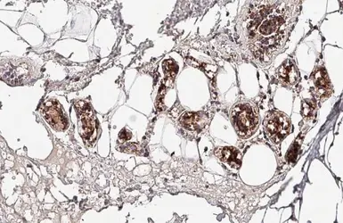 Anti-mtTFA antibody used in IHC (Paraffin sections) (IHC-P). GTX103231