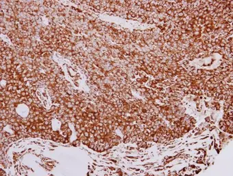 Anti-GRP94 antibody used in IHC (Paraffin sections) (IHC-P). GTX103232