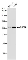 Anti-GRP94 antibody used in Western Blot (WB). GTX103232