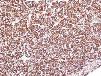 Anti-GRP94 antibody used in IHC (Paraffin sections) (IHC-P). GTX103232