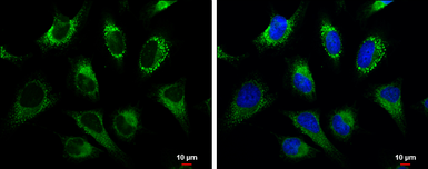 Anti-GRP94 antibody used in Immunocytochemistry/ Immunofluorescence (ICC/IF). GTX103232