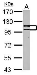 Anti-USP4 antibody used in Western Blot (WB). GTX103237