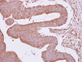 Anti-ARHGAP4 antibody [N1N2], N-term used in IHC (Paraffin sections) (IHC-P). GTX103253