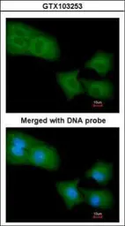 Anti-ARHGAP4 antibody [N1N2], N-term used in Immunocytochemistry/ Immunofluorescence (ICC/IF). GTX103253