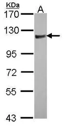 Anti-ARHGAP4 antibody [N1N2], N-term used in Western Blot (WB). GTX103253