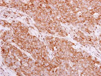 Anti-BIN1 antibody used in IHC (Paraffin sections) (IHC-P). GTX103259