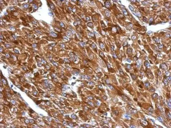 Anti-BIN1 antibody used in IHC (Paraffin sections) (IHC-P). GTX103259