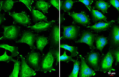 Anti-BIN1 antibody used in Immunocytochemistry/ Immunofluorescence (ICC/IF). GTX103259