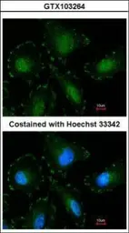 Anti-Calpain 5 antibody [N1C1] used in Immunocytochemistry/ Immunofluorescence (ICC/IF). GTX103264