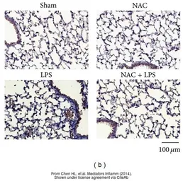 Anti-KLF5 antibody used in IHC (Paraffin sections) (IHC-P). GTX103289