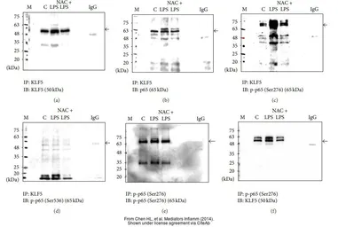 Anti-KLF5 antibody used in Western Blot and Immunoprecipitation (WB IP). GTX103289