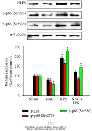 Anti-KLF5 antibody used in Western Blot (WB). GTX103289