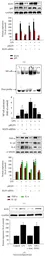 Anti-KLF5 antibody used in Western Blot (WB). GTX103289