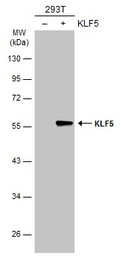 Anti-KLF5 antibody used in Western Blot (WB). GTX103289