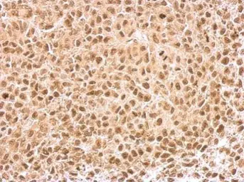 Anti-KLF5 antibody used in IHC (Paraffin sections) (IHC-P). GTX103289