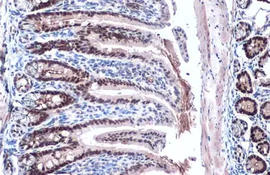 Anti-KLF5 antibody used in IHC (Paraffin sections) (IHC-P). GTX103289